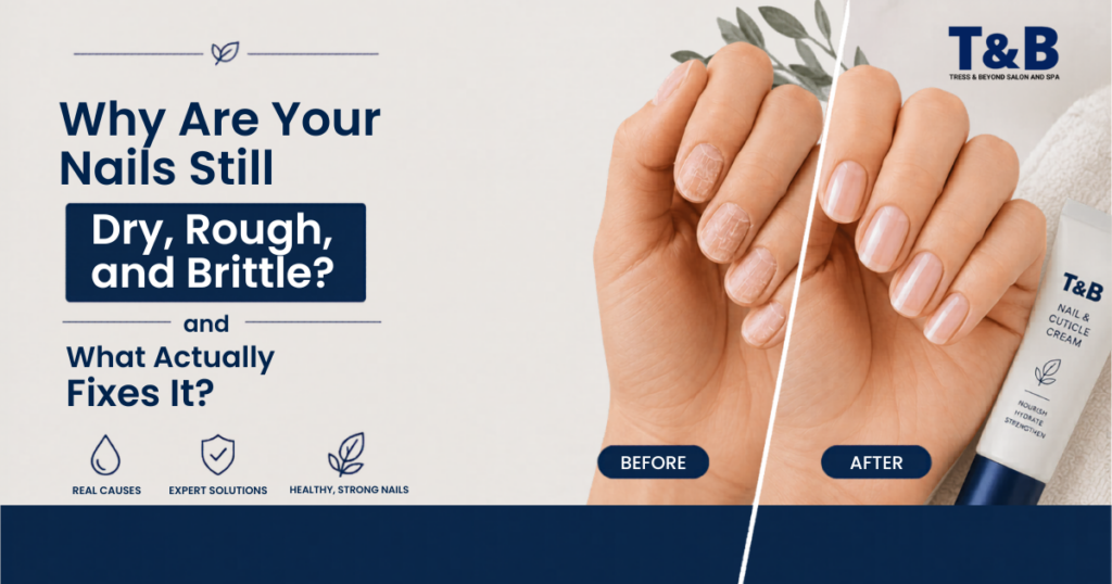 lose-up of dry, rough, and brittle nails showing peeling and breakage
